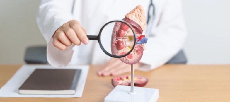 Cause of kidney stone 1 34