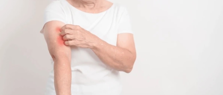 How dangerous a disease Lupus is. 4