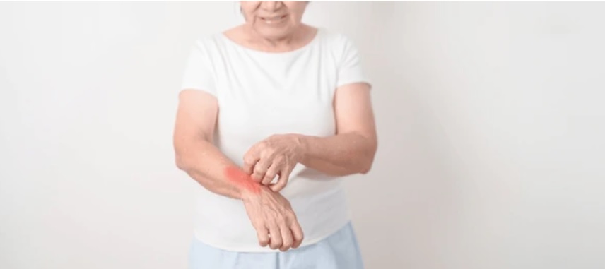 How dangerous a disease Lupus is. 5